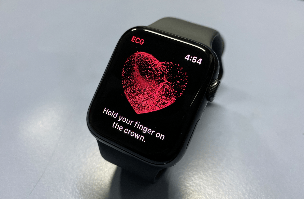 "ECG: Apple Watch Series 5"